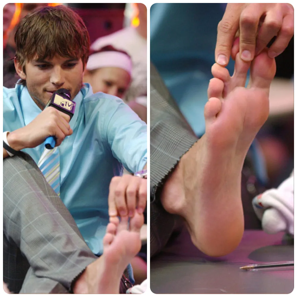Some Famous People Who Have Abnormalities You Probably Haven’t Noticed
